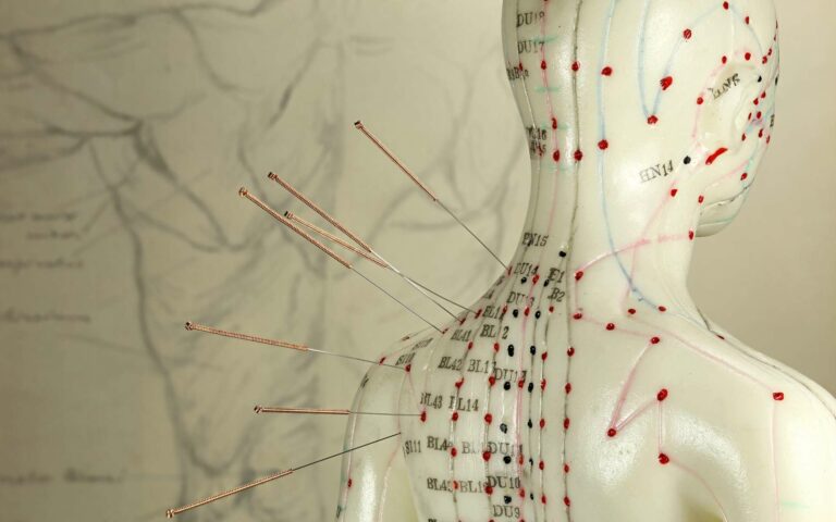 ACUPUNCTURE – Collectif No FakeMed